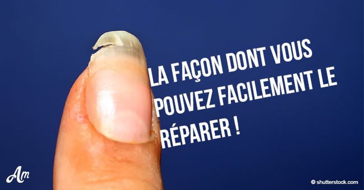 Ongles cassés ? Cette astuce facile vous aidera à les réparer rapidement