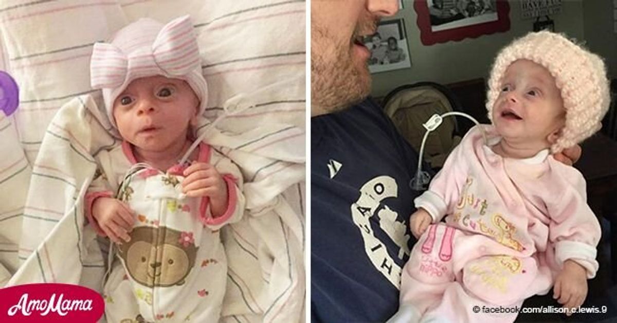 Cette Adorable Petite Fille N e Sans Cerveau Est D c d e Le Sourire Aux cette-adorable-petite-fille-n-e-sans-cerveau-est-d-c-d-e-le-sourire-aux