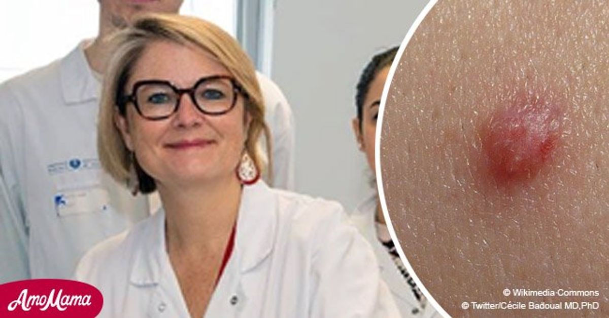 papillomavirus-humains-risques-et-pr-vention-le-docteur-s-exprime